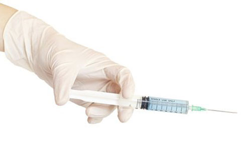 collagenase injections for Peyronies disease