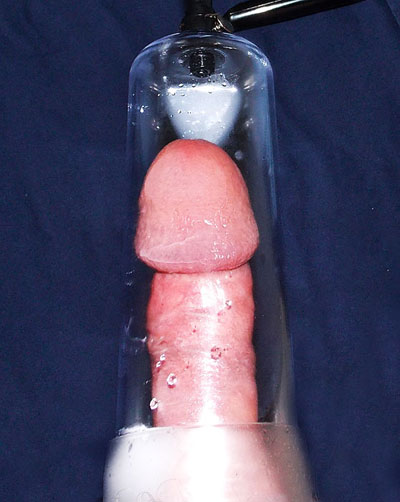penis stretchers: pump