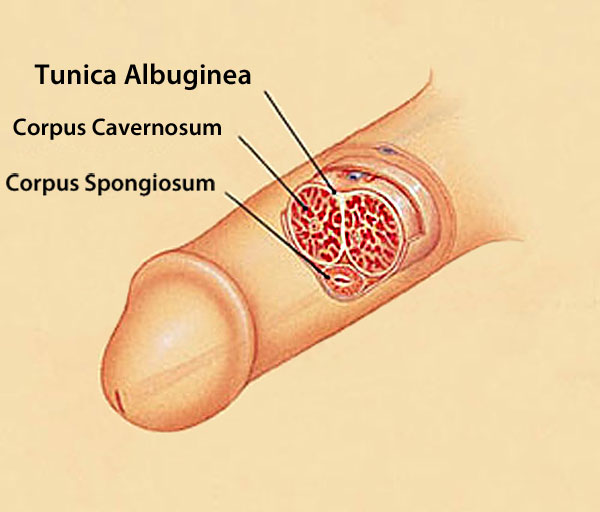 bent penis causes, tunica albuginea